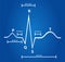 Normal Electrocardiogram Graphic