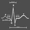 Normal Electrocardiogram Graphic Explained