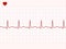 Normal electronic cardiogram. EPS 8