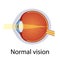 Normal Eye Vision Illustration. Human Eye Optical System. Detailed Anatomy of Healthy Eyeball. Correct Vision Concept