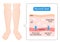 Normal feet and skin diagram illustration. maintain the balance of fluids both inside and outside of cells.  Health care and