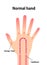 Normal hand blood circulation illustration