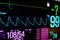 Normal heart function on pulse oximeter pleth graph bar