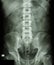 Normal human\'s lumbosacral spine