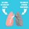 Normal lung and lung cancer illustration