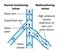 Normal and malfunctioning vein valves