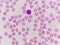 Normochromic normacytic red blood cells