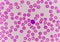 Normochromic normacytic red blood cells