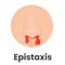 Nosebleed icon. Epistaxis concept. Bleeding from the nose