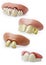 Novelty teeth