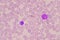 Nucleated Red Blood Cells  NRC in blood smear