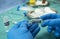 Nurse holds ampoule of anesthesia, preparation to extract cerebrospinal fluid to investigate causes in a person affected by