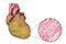 Obese heart, illustration