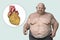 Obese heart in overweight man, 3D illustration. Concept of obesity and inner organs disease