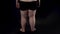 Obese male legs on dark background, health problems, insecurities, disease