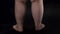 Obese male legs turning around dark background, body care, unhealthy nutrition