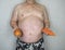 Obesity - Obese Man With Fruit & Veg