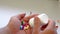 Obesity patient take medicine colorful tablets, pills and capsules in hand for treatment and cure disease or sickness.