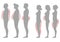 Obesity woman and man body type, vector figure overweight silhouette