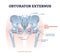Obturator externus muscle location and hip skeletal structure outline diagram