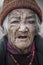 Old lady from Lamayuru village with eye problems cataracts glaucoma