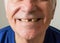 Old man senior face closeup missing tooth smile proper tooth care