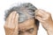 Old woman felt a lot of anxiety about hair loss issue