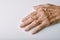 Old woman`s deform hands, Finger pain and stiffness from arthritis in senior people