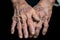 an older womans hands with wrinkled skin