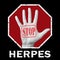 Open hand with the text stop herpes