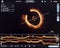 optical coherence tomography oct image angiography catheter lab atherosclerosis