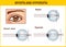 Optical human eye defects. Myopia and hyperopia. Anatomical structure of human eye, Stock vector