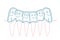 Orthodontic silicone trainer. Invisible braces aligner, retainer.