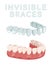 Orthodontic silicone trainer. Medical drawing in cartoon style.
