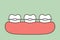 Orthodontic teeth or dental braces
