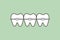 Orthodontic teeth or dental braces