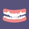 Orthodontic teeth problem crowding. Abnormal eruption. Double tooth