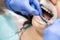 Orthodontics. The dentist carries out the procedure for servicing braces in the patient