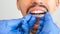 Orthodontist doctor putting silicone invisible transparent braces on man`s teeth