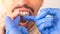 Orthodontist doctor putting silicone invisible transparent braces on man`s teeth