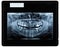 Orthopantomograph panoramic image radiograph of teeth