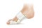 Orthopedic toe corset, Hallux Valgus treatment