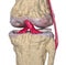 Osteoarthritis : Knee joint with ligaments