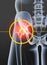 Osteoarthritis, painful hip joint, 3D illustration