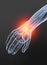 Osteoarthritis, painful wrist joint, 3D illustration on black background