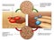 Osteoblast & osteoclast