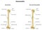 Osteomyelitis Infection