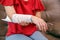 Osteoporosis splint with elastic bandage is applied to help keep the splint in place