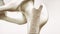 Osteoporosis stage 2 of 4 - upper limb bones - 3d rendering