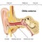 Otitis externa ear disease 3d medical vector illustration on white background